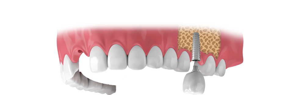 öƮ ̶̽?