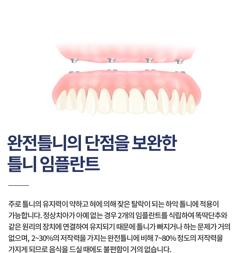 öƮ Ʋ