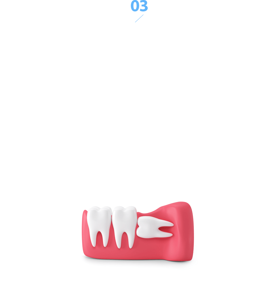 ź   